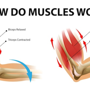 Triceps vs Biceps: Which Muscle Group is More Prone to Tendonitis and How to Prevent It.