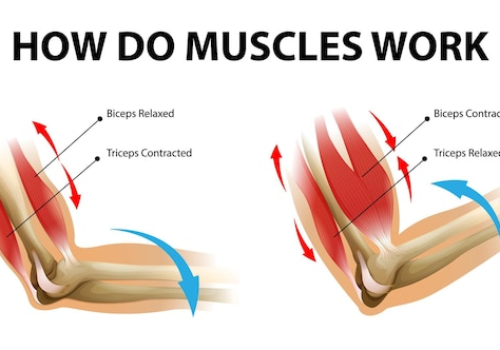 Triceps vs Biceps: Which Muscle Group is More Prone to Tendonitis and How to Prevent It.